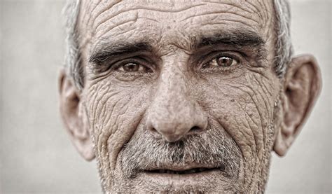 Wrinkles Iscn