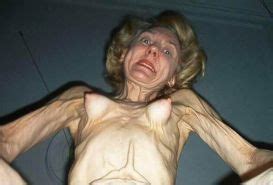 Extremely Skinny Granny Posing Porn Pictures Xxx Photos Sex Images Pictoa