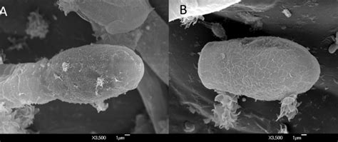 Micrografía con microscopía electrónica de barrido de Erysiphe diffusa