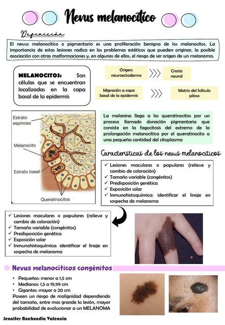 Nevus Melanociticos Y Melanoma Jenmedtips Udocz