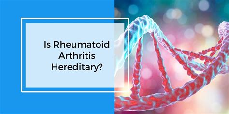 Rheumatoid Arthritis Hereditary Review True Or Not