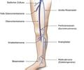 Gm Q Appp Herz Kreislauf Gef Sse Pathophysiologie Ven Se