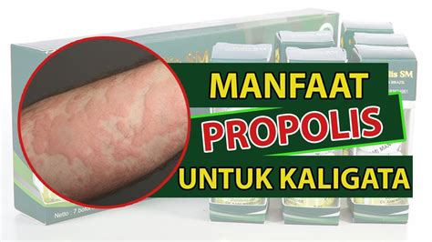 Cara Mudah Mengatasi Dan Mencegah Kaligata Dengan Propolis Tips