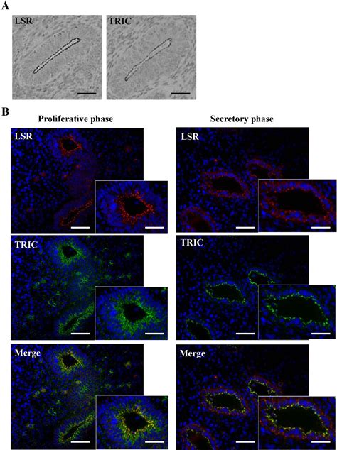 Figure 1 From The Roles Of Tricellular Tight Junction Protein Lipolysis Stimulated Lipoprotein