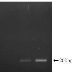 Formation of the perivitelline space (PVS) in mouse oocytes during in... | Download Scientific ...