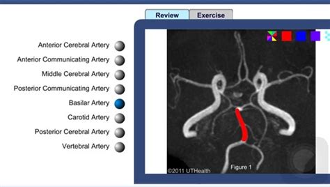 Pathology Mri Flashcards Quizlet