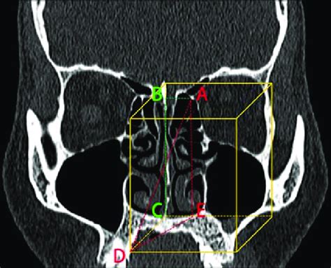 The 3 Dimensional Space Between The Ans And The Aef Was Constructed Download Scientific