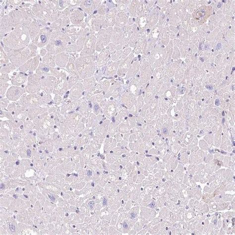 Anti MYOZ1 Antibody Produced In Rabbit