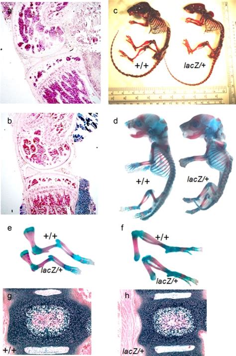 Tnnt Heterozygous Mice Have A Mild Skeletal Phenotype X Gal Staining