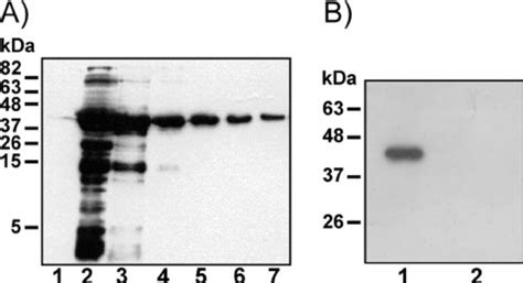 Heterologous Expression Purification And Detection Of Emabp A