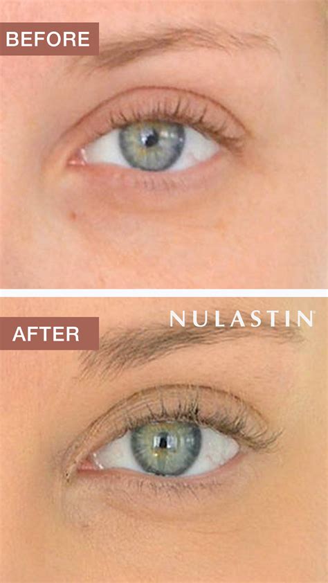 Increase Brow Thickness By 120 And Lash Length By 60 Clinical