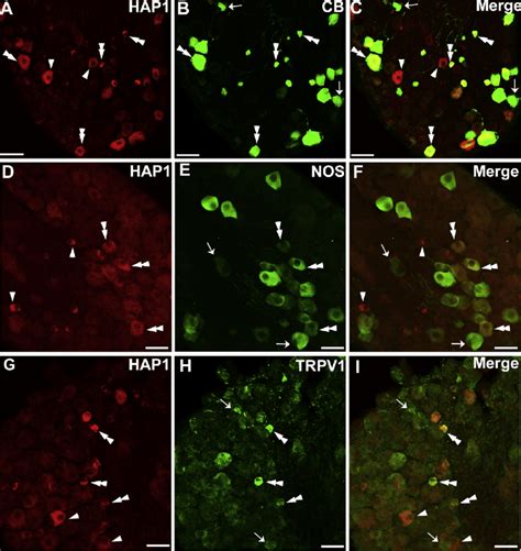 Double Label Immunofluorescence Immunohistochemistry For Hap1 With Cb Download Scientific