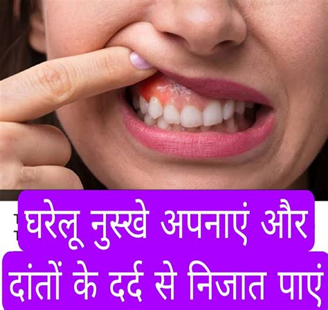 Home Remedy घरेलू नुस्खे अपनाएं दांतों के दर्द से निजात पाएं इन 4 घरेलू उपायों से मिलेगी राहत