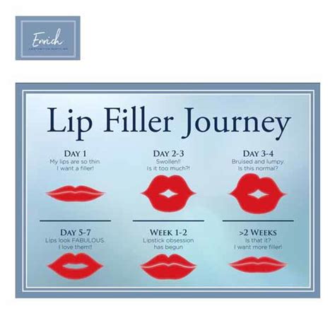 Lip Filler Journey Aftercare Leaflets Pack Of 20