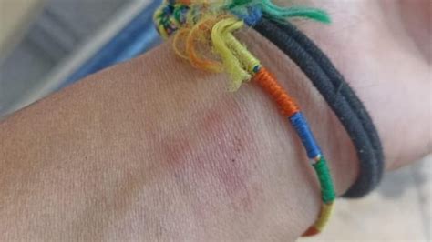 Non Accetta La Relazione Gay Della Figlia Accoltella Lei E La Compagna Ottopagine It Salerno