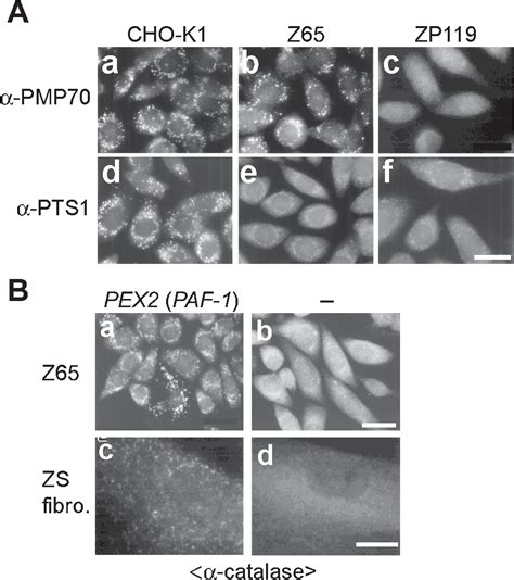 Peroxisome biogenesis disorders | Semantic Scholar 