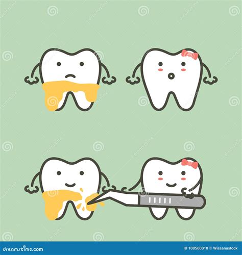 Step of Teeth Scaling - Dental Plaque Removal, before and after Stock Vector - Illustration of ...