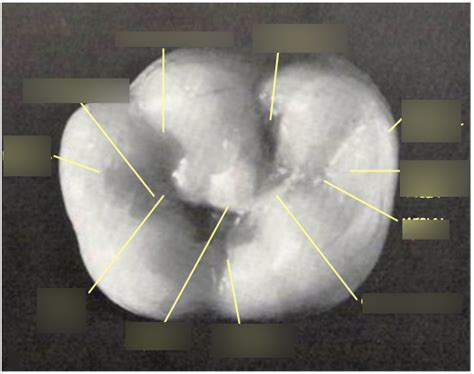 Deciduous Mandibular Left 2nd Molar K 75 Diagram Quizlet