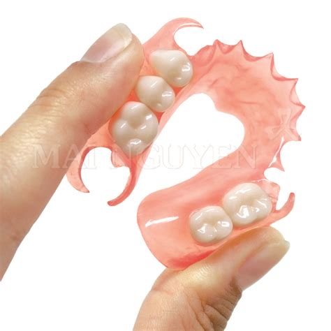 Flexible Dentures Dr Ashish Shah