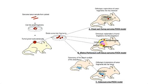 Establishment Of A Patient Derived Orthotopic Xenograft Pdox Models