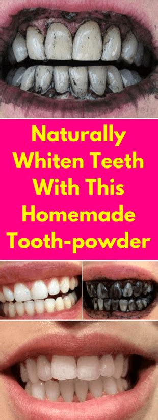 Pin On Homemade Whitening Of Teeth