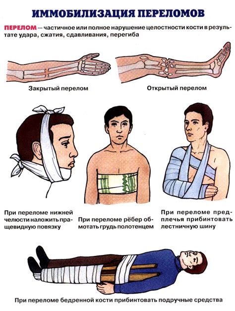 Виды ран картинки (Много фото) - artshots.ru