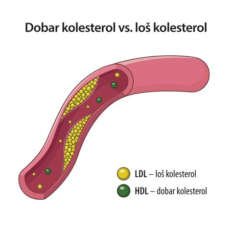 Dobar loš i zao LDL i HDL kolesterol