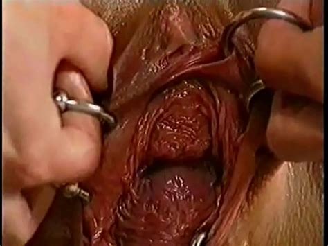 Monster Vagina Perforación extrema Puño XVIDEOS