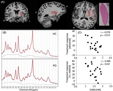 A Exemplary Placement Of An Mrs Magnetic Resonance Spectroscopy