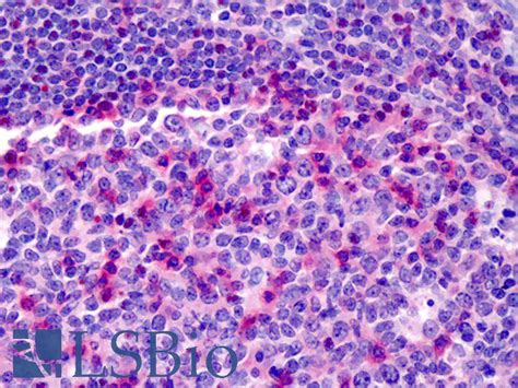 IHC Plus CD69 Monoclonal Antibody Mouse Anti Human LSBio