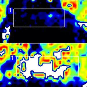 Laser Doppler Perfusion Imaging Perfusion Signals Are Converted Into A