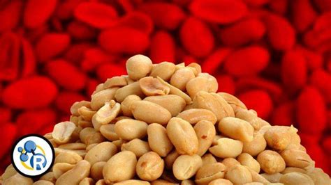 Video: Why are people allergic to peanuts?