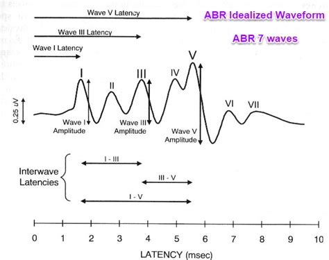 Auditory Brainstem Response ABR Waves What Nuclei Generate Each Of