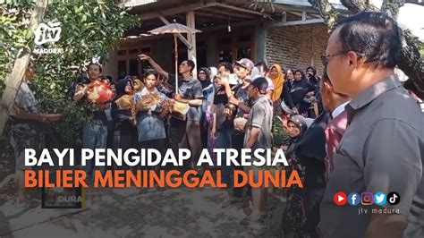 Belum Sempat Operasi Bayi Pengidap Atresia Bilier Meninggal Dunia