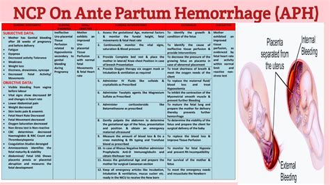 🎉 Nursing Care Plan For Postpartum Hemorrhage Care Plan Postpartum