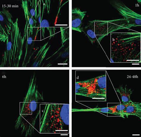 Backpack And Encapsulation Approaches A Scanning Electron Microscope