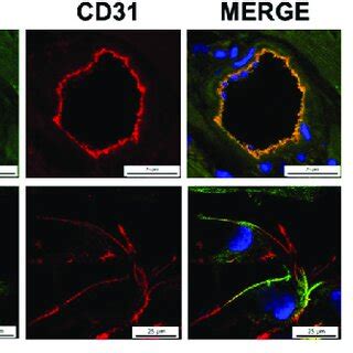 CD146 Is Predominantly Expressed In ECs Of Adult Mouse Hearts A CD146