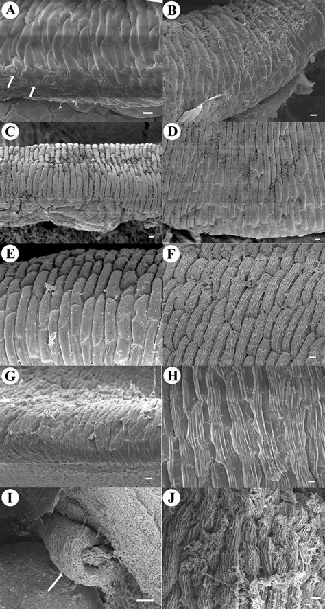 Rostellum micrographs. Rostellum development of Coelia triptera (A, B).... | Download Scientific ...