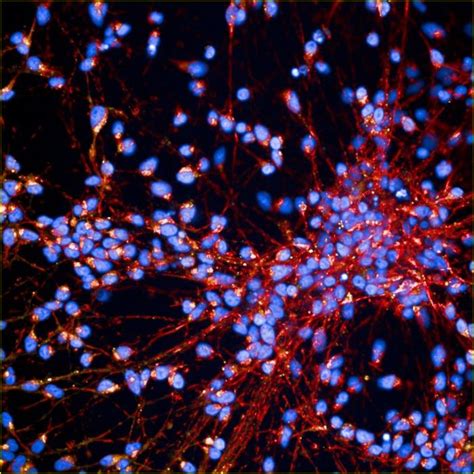 Cortical Nerve Cells Generated [image] Eurekalert Science News Releases