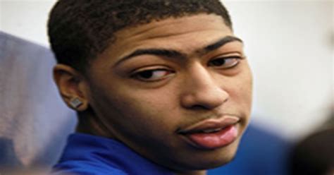 Anthony Davis Eyebrow - jawapan wed