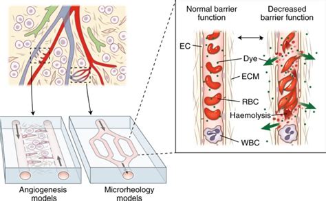 Modelling Microvascular Pathology Nature Biomedical Engineering