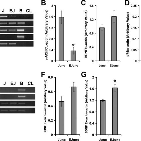 Expression Of BDNF And P75 NTR Is Observed In Junctional And