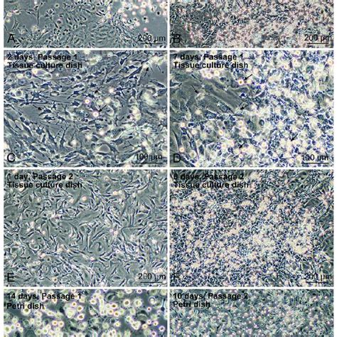 Phase Contrast Micrographs Showing The Propagation Of Liver Download Scientific Diagram