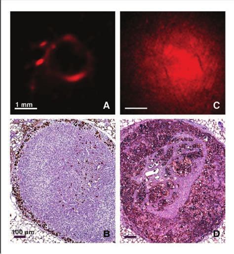 Development Of Lymph Node Metastases A And B Fluorescence Image And Download Scientific