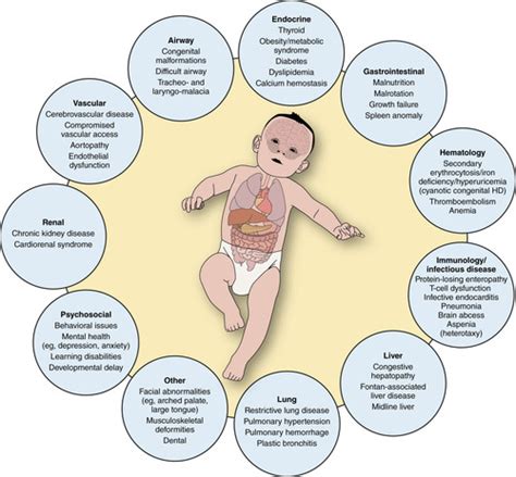 Perioperative Considerations For Pediatric Patients With Congenital Heart Disease Presenting For