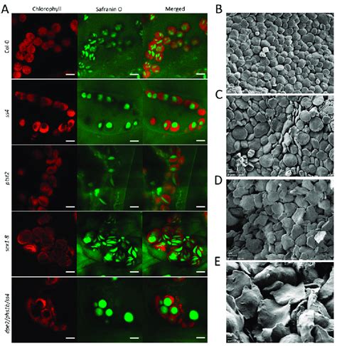 In Vivo And In Vitro Observation Of Starch Granules Of Sex1 8 Starch Download Scientific