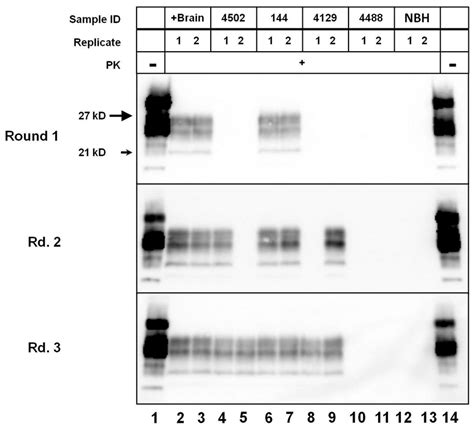 Serial PMCAb Detection Of Prion Seeding Activity In CSF From