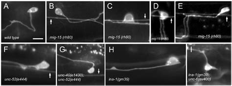 Mutations Affect The Direction Of Hsn Axon Protrusion Ag