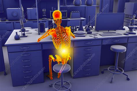Musculoskeletal Disorders In Lab Workers Illustration Stock Image