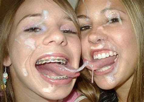 Braces Party Nude Telegraph